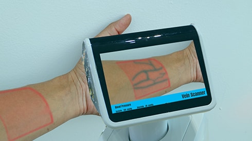 Vein imaging